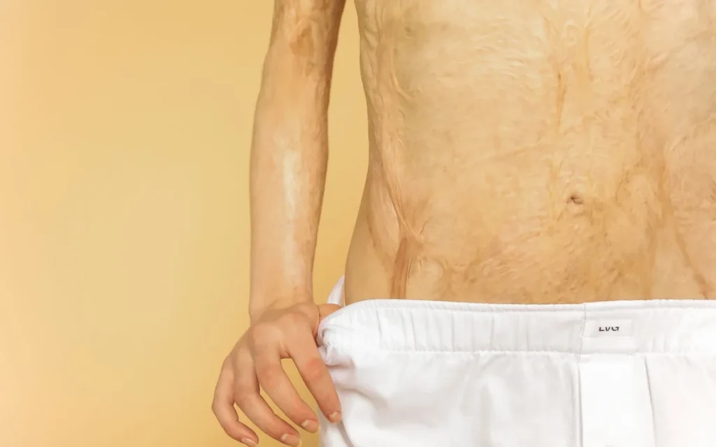 Anatomia i stan skóry - dlaczego liczba nici nie wynika z szablonu?